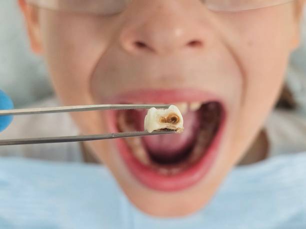 Best Emergency Pediatric Dental Care in Justice, OK
